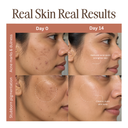Potato Pulp Serum