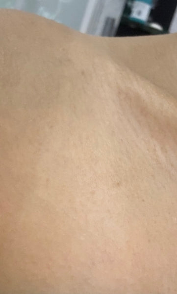 After Use