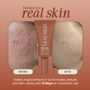 Potato Pulp Serum